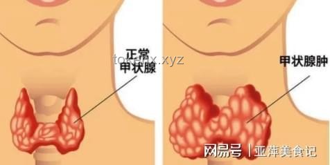 **每一次怒氣，都是對甲狀腺的隱形傷害??**