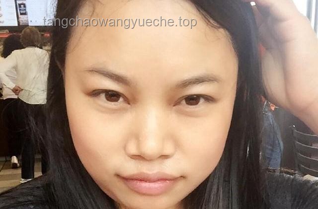 “牙爛了人胖了”：初代網紅鳳姐近況曝光引發的思考