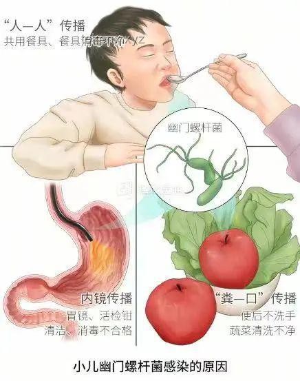 “這個細菌一人感染全家都得查”——幽門螺桿菌家庭感染案例研究
