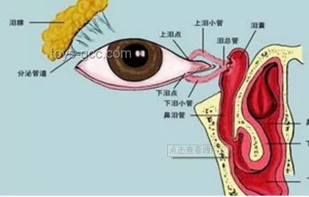 **淚囊異常癥狀對比：女子右眼狂飆淚與常見淚道疾病**