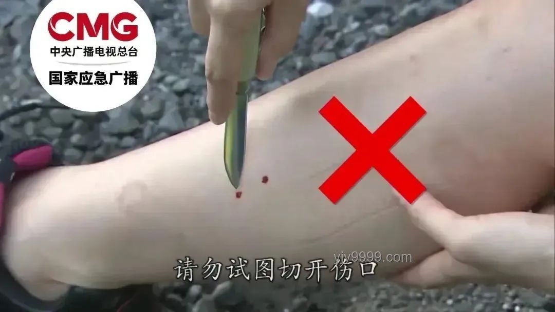 三亞旅游安全漏洞：游客被不明物咬傷身亡事件深度剖析