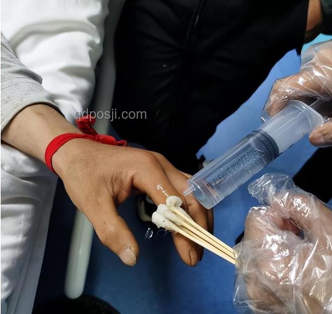 被蛇咬后應急處理指南