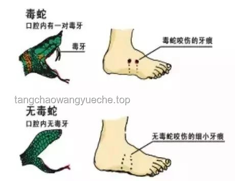 毒蛇咬傷啟示錄：跨界救援與應急創新