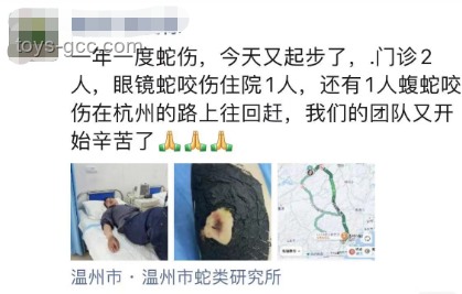 女生河邊散步被蝮蛇咬傷腳應急處理