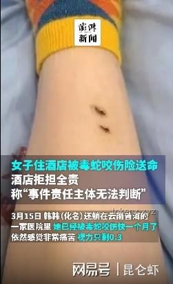 女子被毒蛇咬傷兩年后遺癥案例研究