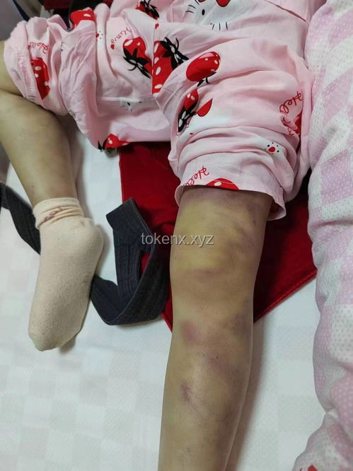 3歲女童被虐致死案一審二審對比分析