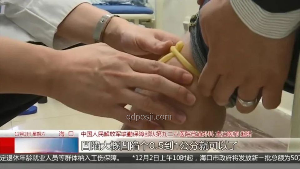 三亞被咬女子案：了解神經(jīng)毒蛇咬傷知識