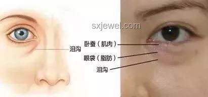 王安宇眼睛問題解決方案：改善視力與眼部健康