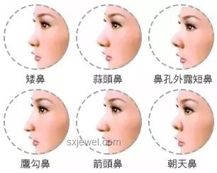 什么樣的鼻子才算高鼻梁，判定標準揭秘