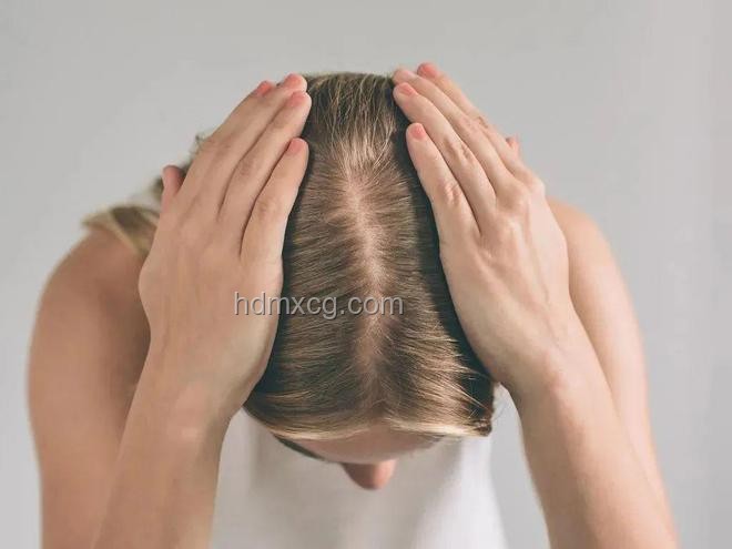 衛健委辟謠：頻繁洗頭不會導致脫發問題解決方案