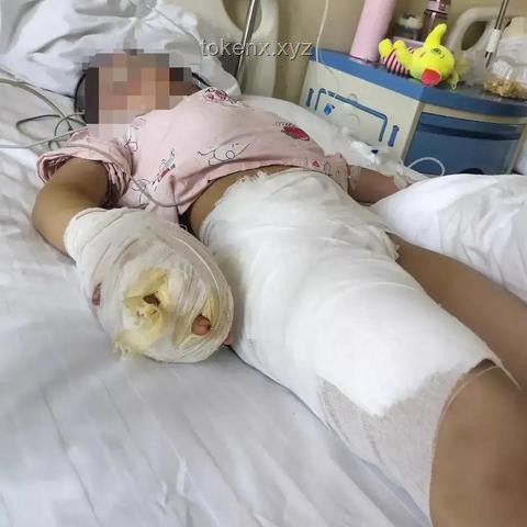 男童遭虐待致輕傷二級：如何保護(hù)兒童權(quán)益與生父責(zé)任認(rèn)知