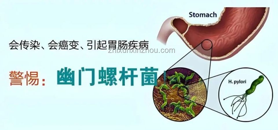 良子的胃袋：是生命的奇跡還是隱藏的危機？