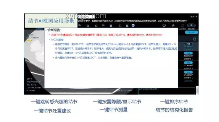 AI驅(qū)動(dòng)的醫(yī)療影像診斷革新